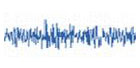 15-18 Hz